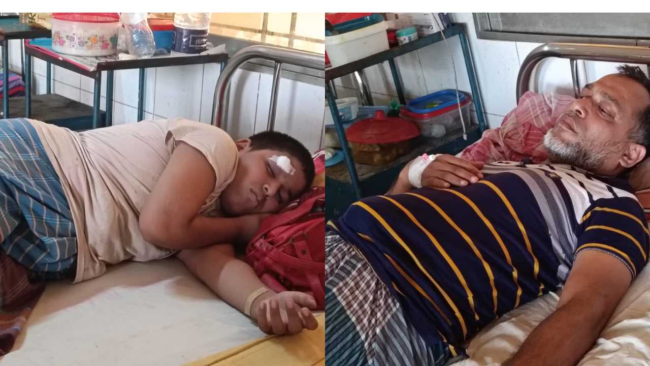 জমিজমার বিরোধে বাবা ছেলেকে কুপিয়ে মারাত্মক জখম